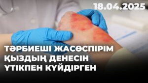 Тәрбиеші жасөспірім қыздың денесін үтікпен күйдірген | 18.04.2025