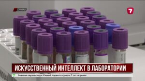В Алматы ИИ начал работать в медицинской лаборатории