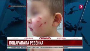 Помощница воспитателя поцарапала спящего малыша в саду
